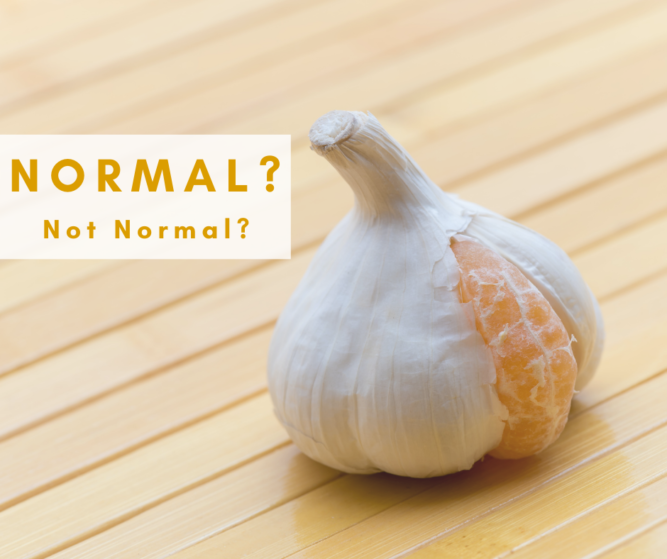 Normal vs. not-normal